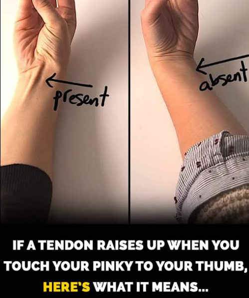 How to check if you’ve lost this tendon on your arm to evolution